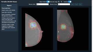 Portable DICOM Viewer (PDW)