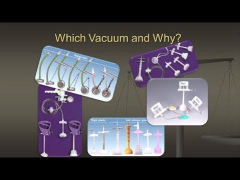 Everything You Ever NEEDED to Know About Vacuum Assisted Delivery