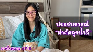 ผ่าตัดถุงน้ำดี | มากับแอล EP.8