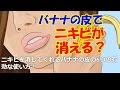ニキビを消してくれるバナナの皮の6つの有効な使い方！