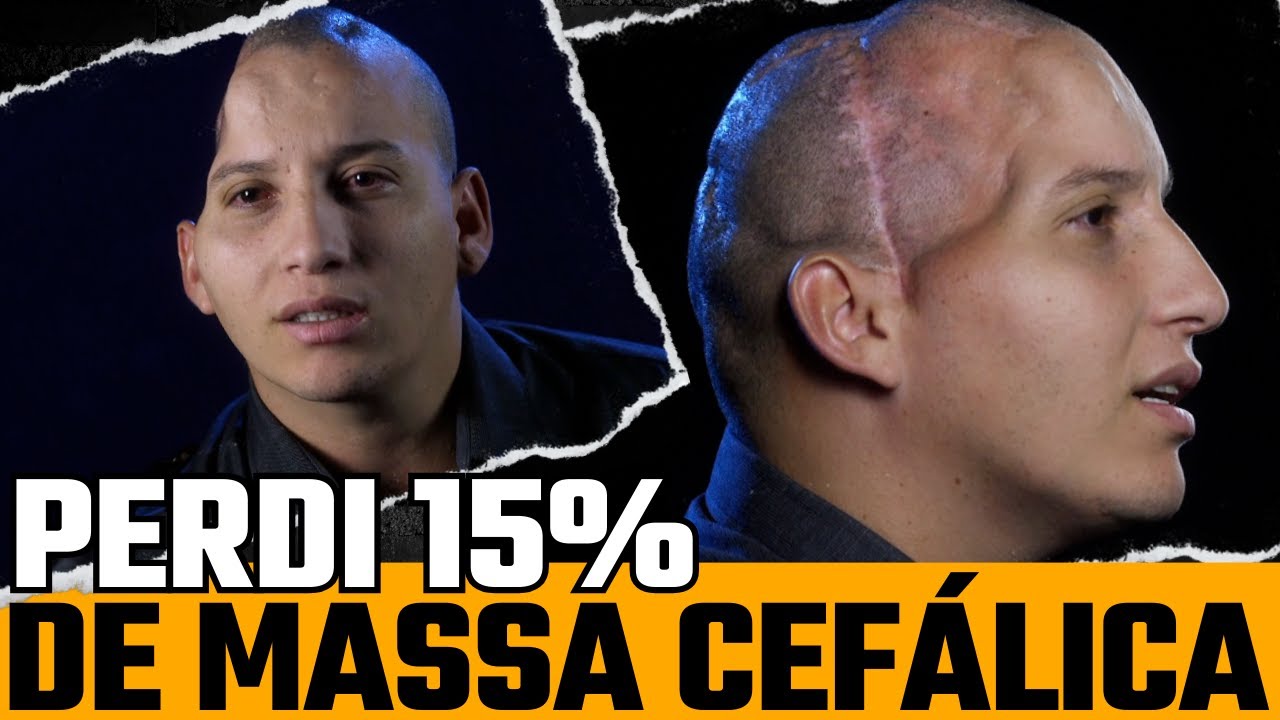 P&S - PERDI 15% DE MASSA CEFÁLICA - YouTube