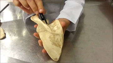 O que passa na incisura escapular?