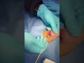 Sedated cat ear cleaning 🐱