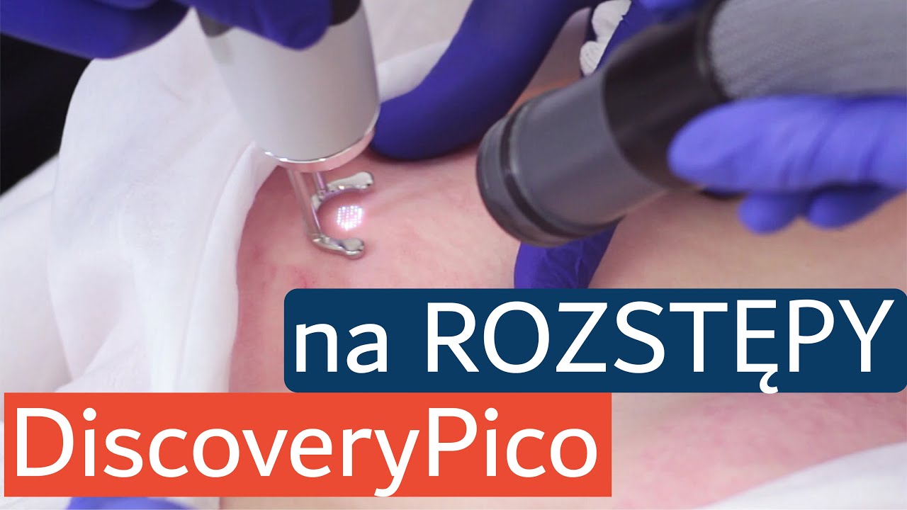 Usuwanie rozstępów laserem pikosekundowym Discovery Pico