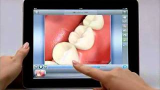 歯科iPadアプリMedVisor dental for iPad screenshot 3