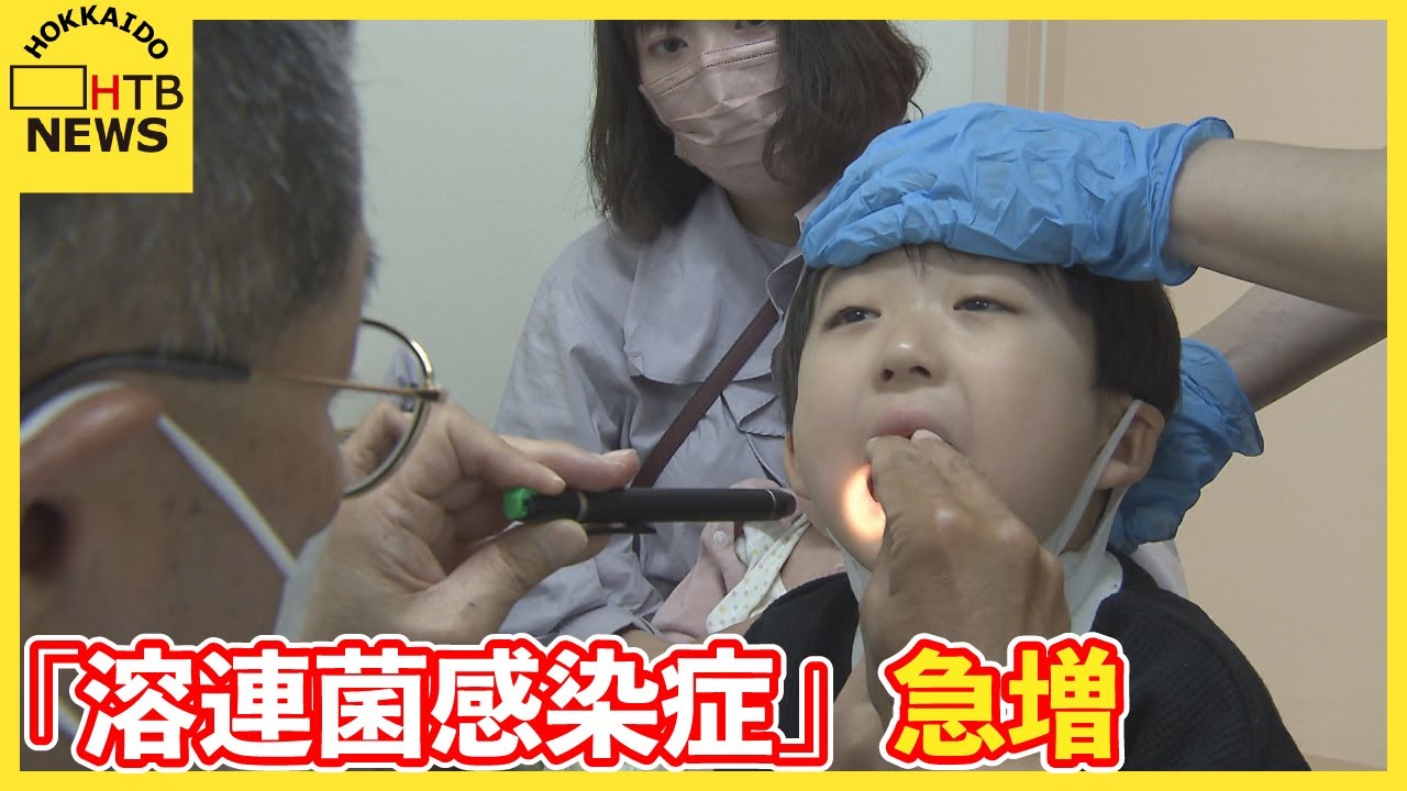 溶連菌 検査 方法