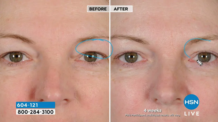 NassifMD Peri Orbital Eye Complex Duo