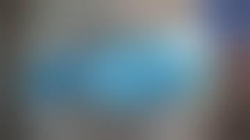 Hypermature cataract without epinucleus: Blocked tip, Soft shell, flying pieces Phacoemulsification