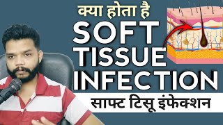 Soft Tissue Infection Kya Hota Hai / Bacterial Infection In Hindi screenshot 2