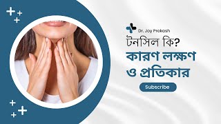 Tonsilitis - Signs & Symptoms । টনসিল কি কারণ লক্ষণ ও প্রতিকার। টনসিল হলে কি করবেন