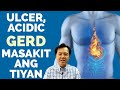 Ulcer, Acidic, GERD at Masakit ang Tiyan - Payo ni Doc Willie Ong #