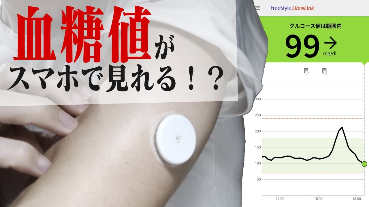 まさかの隠れ糖尿病疑惑？血糖値センサーで自分の体と向き合ってみた！