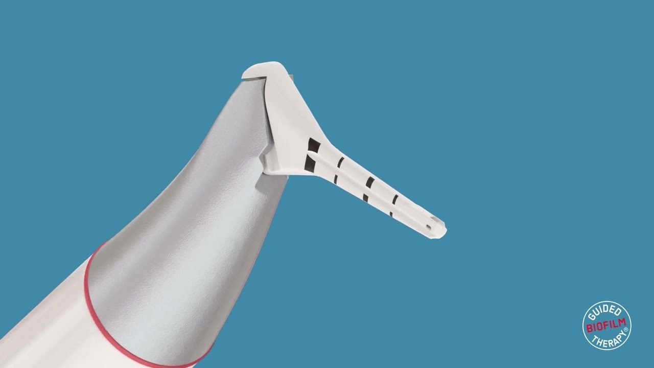 patientpop 3d health explainer-