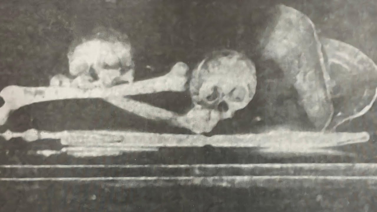 RESUMO DA VIDA E MORTE DE ZÉ BAIANO | CNL | 1844