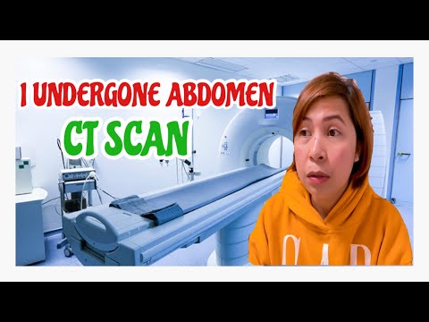 HAVING A ABDOMEN CT Scan: Ang hirap magkasakit pag malayo sa pamilya | Juvielyn Lucero