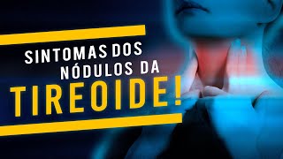 Sintomas dos nódulos de tireoide [Dr. Rogério Leite]