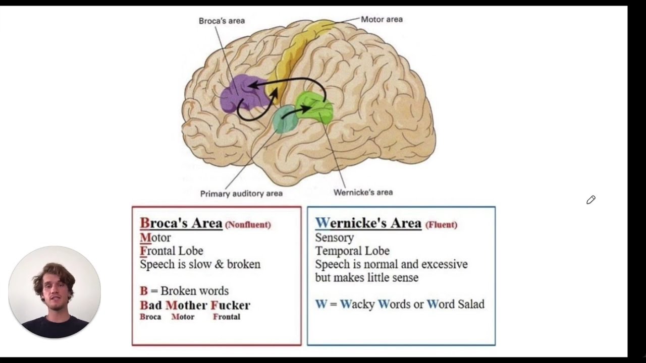 MCAT Question of the Day: Aphasia - YouTube