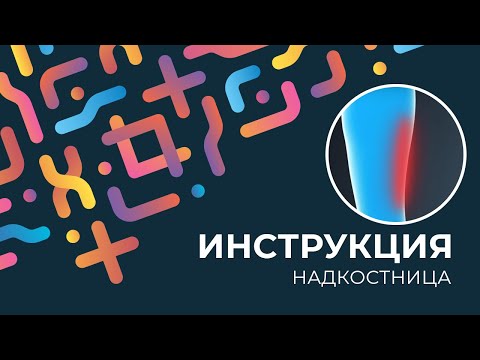 Kinexib - тейпирование надкостницы