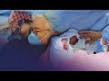 Twin-to-Twin Transfusion Syndrome: A Story of Four Female Twins | Absolute Documentaries
