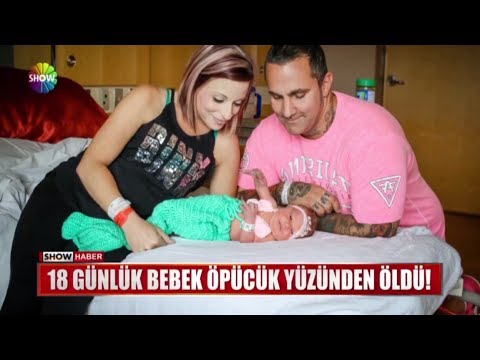 18 günlük bebek öpücük yüzünden öldü!