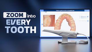 AI-Powered Dental Imaging | Intraoral Camera Mode | Waldent BLZ IntraVue 900 | Dentalkart