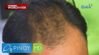 Hair loss problem, paano masosolusyonan? | Pinoy MD