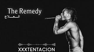 اغنيه العلاج اكس اكس اكس تنتاسيون    xxxtentacion