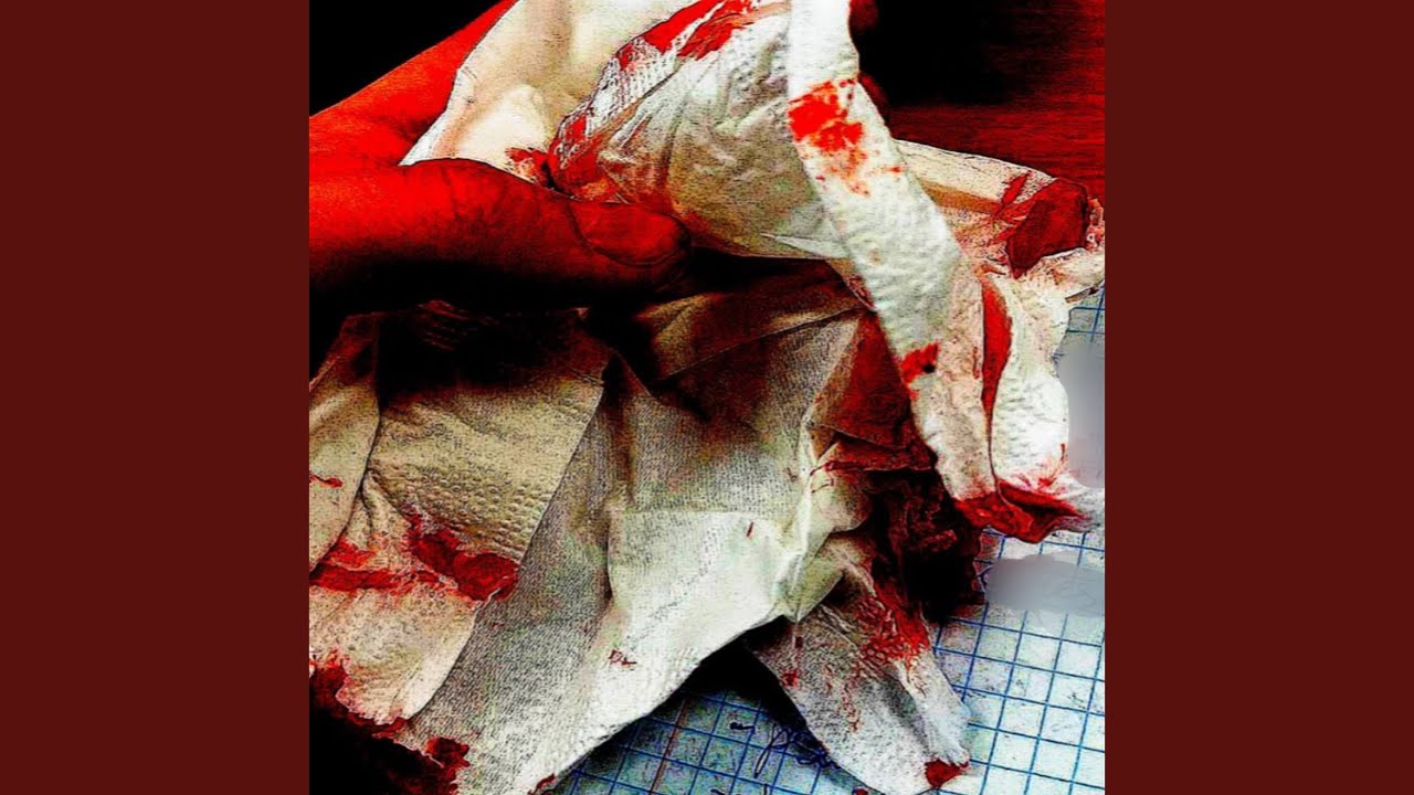 Guarda Needles su YouTube Guarda Needles su YouTube