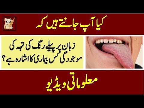 yellow tongue | زبان پر پیلے رنگ کی تہہ کی موجودگی کس بیماری کا اشارہ ہے