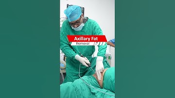 Axillary Fat Removal #short #shorts #Shortvideo #AxillaryFatRemoval #AxillaryFat #Axillary #Fat