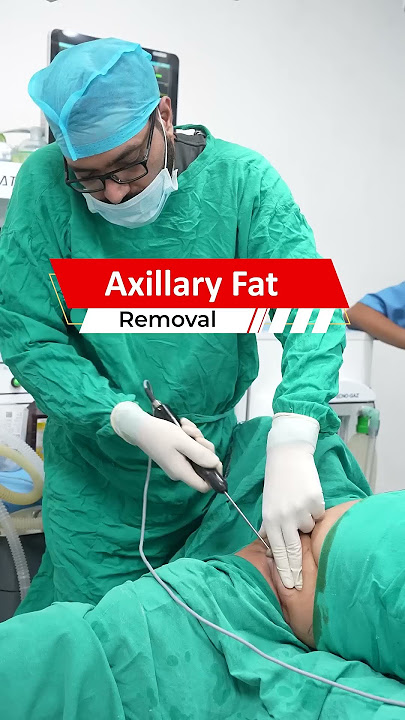 Axillary Fat Removal #short #shorts #Shortvideo #AxillaryFatRemoval #AxillaryFat #Axillary #Fat