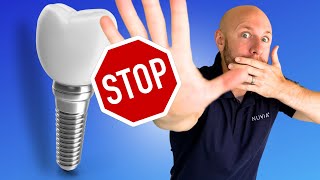 (Don't) Get Dental Implants WITHOUT Knowing These 5 Things!