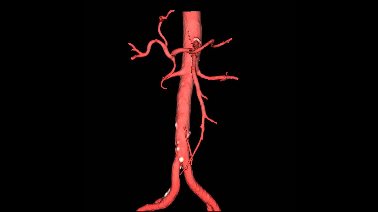 функции артерий. периферические сосуды нижних конечностей. аорты периферических артерий. аорты периферических артерий. аорты периферических артерий.