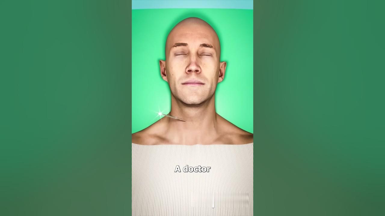 Full Body Transplant π¨(Explained) #ytshorts Full Body Transplant π¨(Explained) #ytshorts