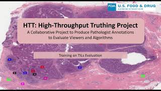 20200219 HTTdataCollectionWebinar TILsEvaluation