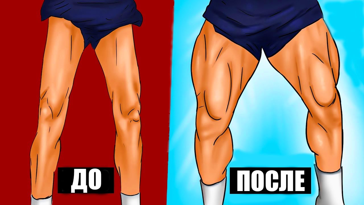 ноги как спички у мужчин что делать