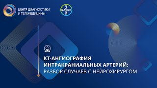 КТ-ангиография интракраниальных артерий: разбор случаев с нейрохирургом