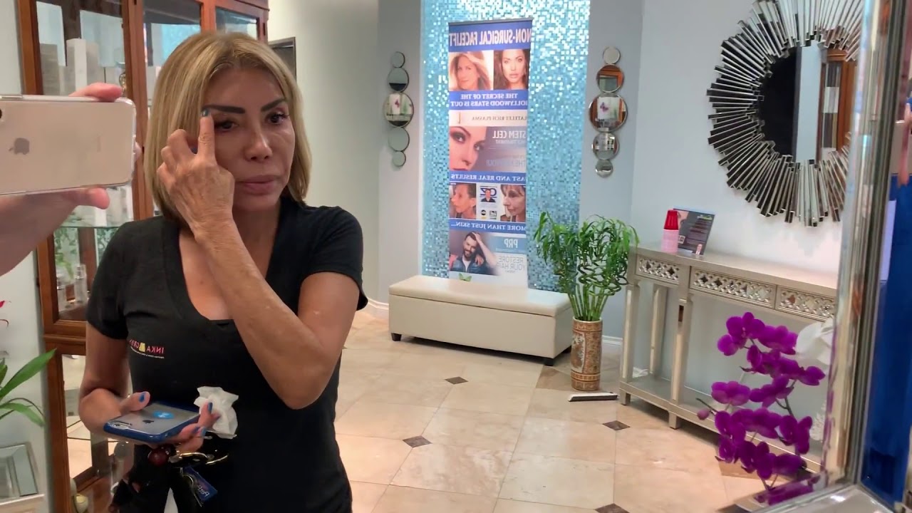 Happy Butterfly Facelift Customer by Jim Hooper The Inventor of the