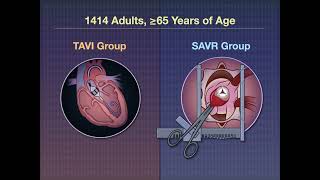 TAVI or SAVR for Aortic-Valve Stenosis | NEJM
