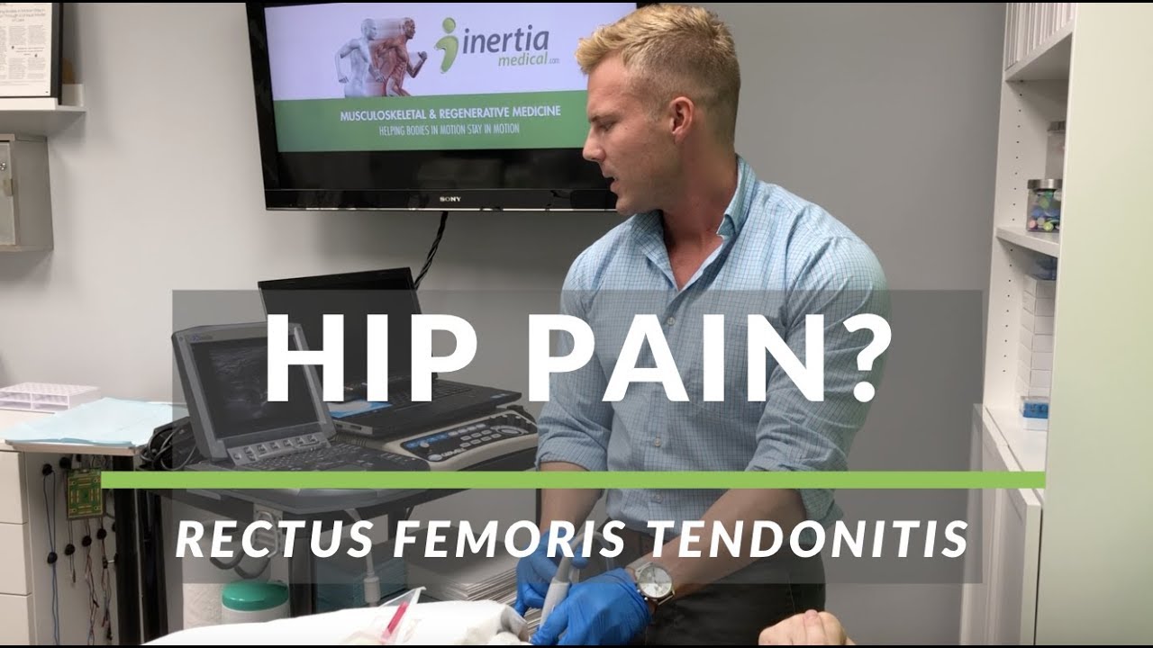 Rectus Femoris Tendonitis