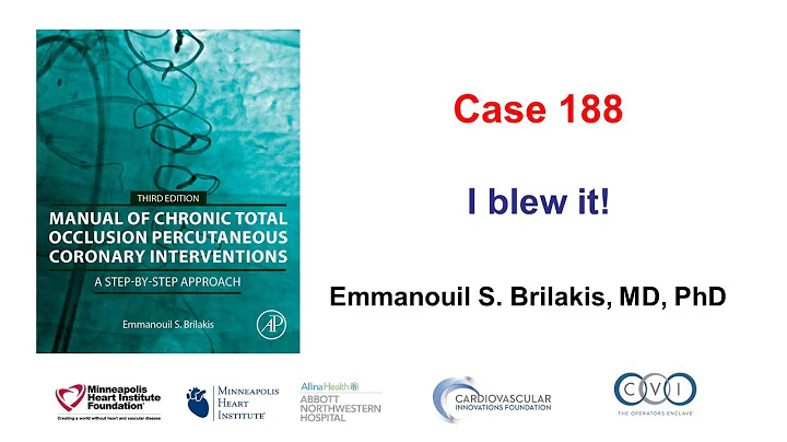Case 188: Manual of CTO PCI - I blew it!