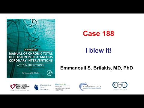 Case 188: Manual of CTO PCI - I blew it!