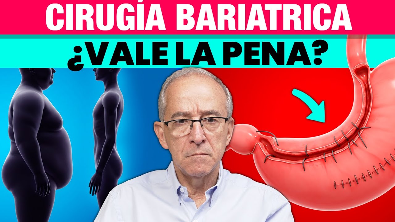 ⚠️ Cirugia Bariatrica, Esto Pasa Si Te Operas Para BAJAR DE PESO - Oswaldo Restrepo RSC