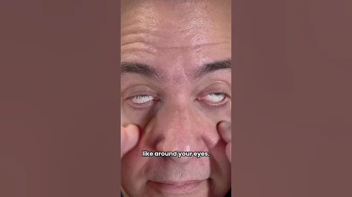 5 Signs You May Be Dehydrated with Dr. Grant