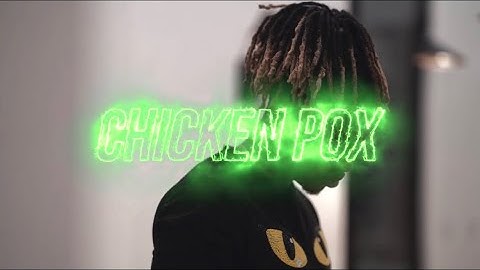 Jock x Plainviewkiet - “Chicken pox” Official Music Video
