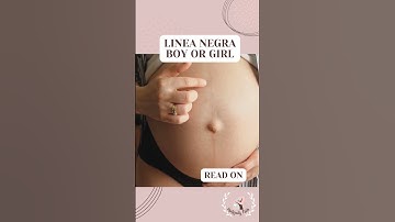 LINEA NIGRA! BOY OR GIRL! GENDER REVEAL! PREGNANCY! PREGNANT AFTER TTC! TTC! #ttc #shorts #pregnancy