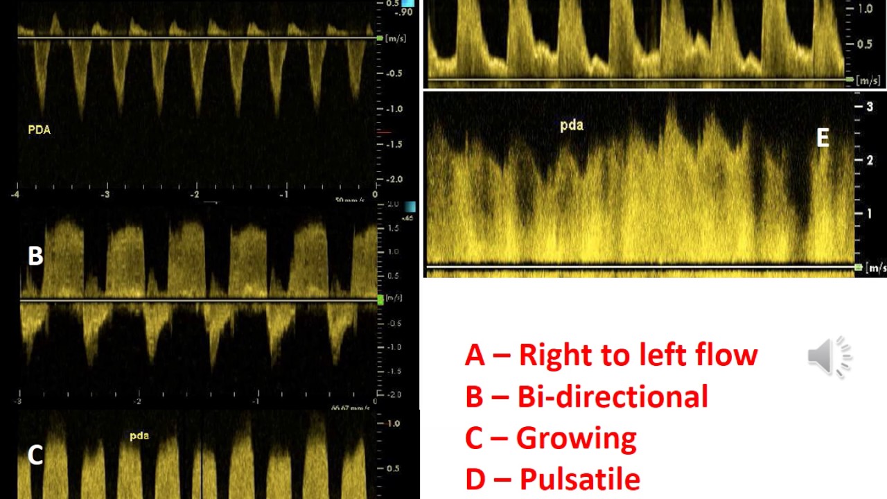 Baby-OSCAR ECHO podcast