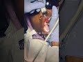 Dental implants in 5 minutes