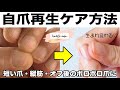 ❗️自爪再生❗️ピンクの部分を伸ばしたい人・短い爪・オフ後のボロボロ爪・縦筋や剥離した爪に効果的！ネイリストみかのネイルケアルーティーン方法紹介します