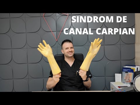 Sindrom de Canal Carpian ( Tunel Carpian) - Tot ce trebuie sa stii